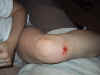 ouch.jpg (47353 bytes)